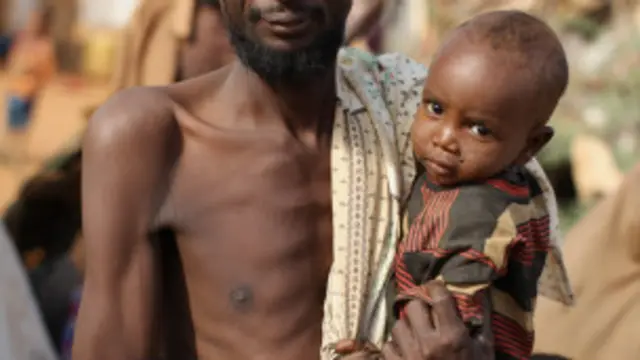 قحط سے مشرقی افریقہ میں ہزاروں افراد ہلاک ہوچکے ہیں: رپورٹ