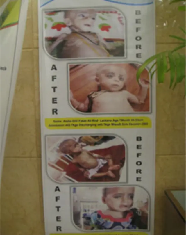 محکمہ صحت کے پروٹین ، نیوٹریشن اور دیگر کئی پروگرام چل رہے ہیں۔