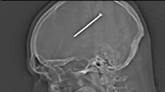 दांते ऑवटुलो