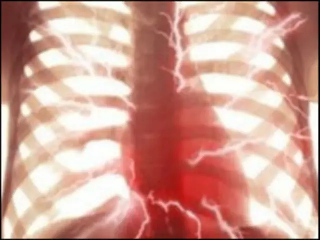 英国心脏病致死率急剧下降