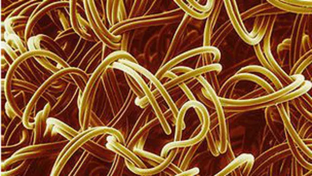 प्लास्टिक