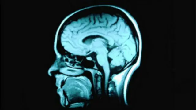 Магнитно-резонансная томограмма