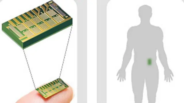 Микрочип