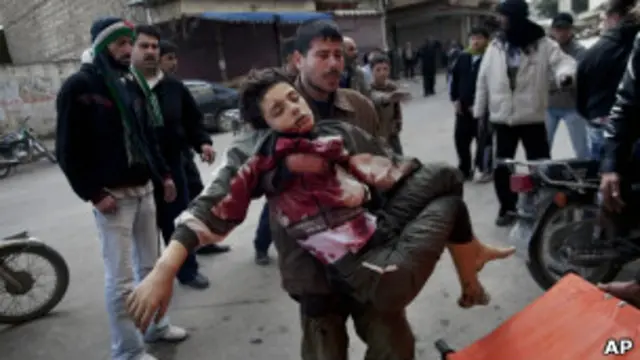 ولد مصاب بشدة