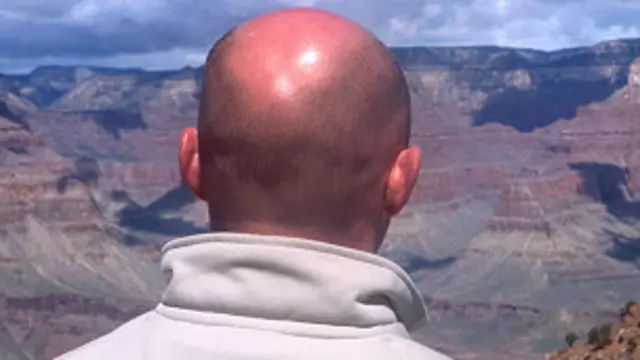 Hombre calvo de espaldas