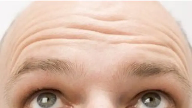 Лисий чоловік