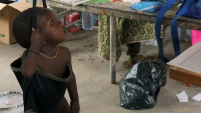 د خيرښيگڼو د چارو متخصيصينو خوارځواکي افريقا کې يوه پټ بحران بللى دى.