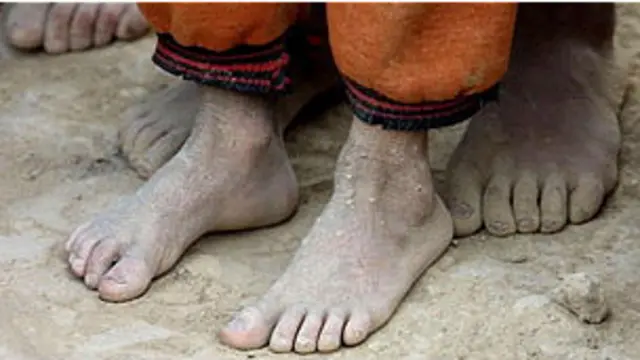 Pies descalzos de niños pobres.