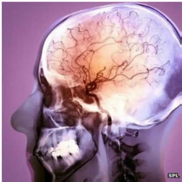 Компьютерная голова