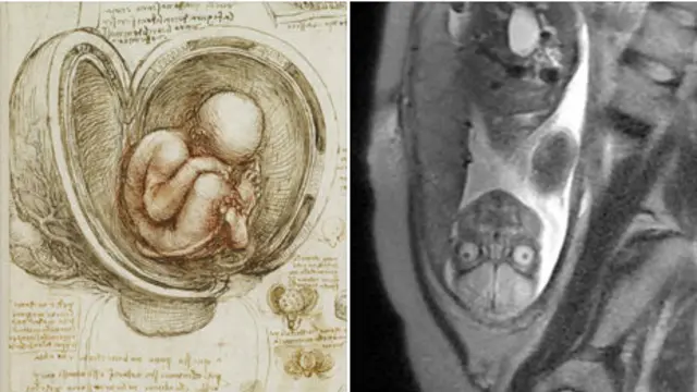 Leonardo'nun embiryo çizimlerinde hatalar bulunuyor.