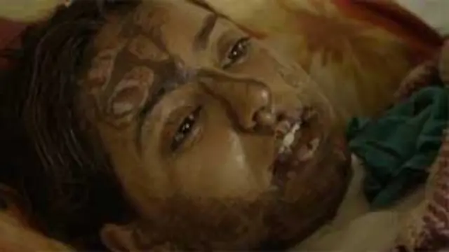 莎玛躺在医院的病床上