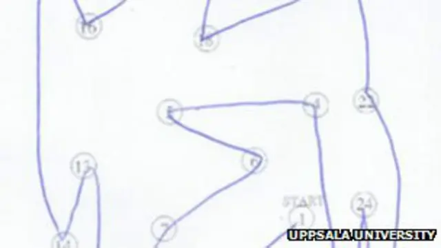 Тест на инсульт