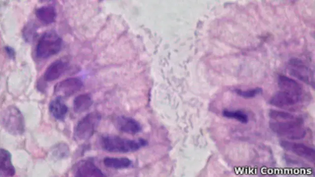 Bactéria Helicobacter pylori. | Foto: Ed Uthman/ Wikimedia Commons