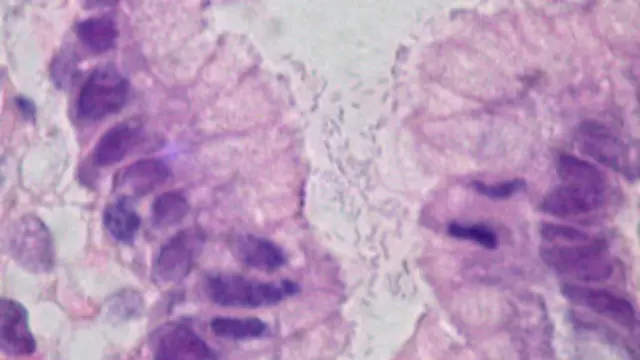 Bactéria | Foto: WikiCommons