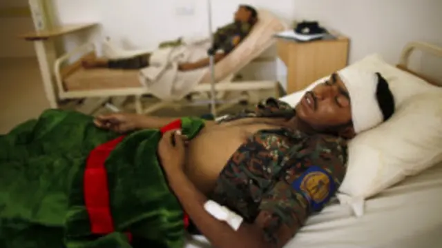 Selain menewaskan 90 orang, serangan bom juga melukai ratusan tentara lainnya. 