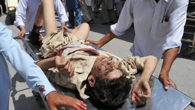 پاکستان کے صوبہ خیبر پختونخوا کے دارالحکومت پشاور میں چارسدہ روڈ پر ہونے والے ایک دھماکے میں کم از کم اٹھارہ افراد ہلاک اور تیس سے زائد زخمی ہوگئے