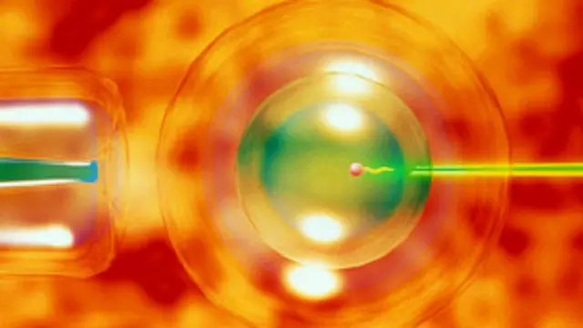 Fertilizacion in vitro