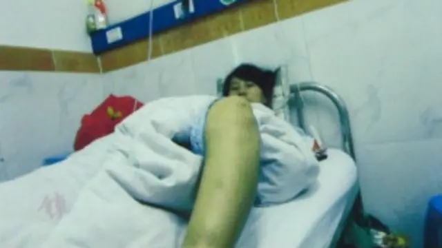 冯建梅被强迫引产后