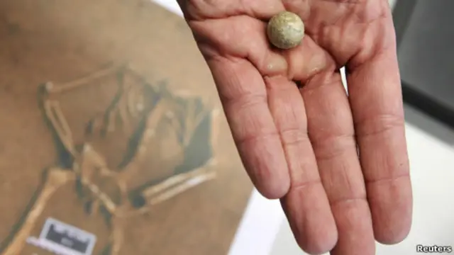 Sebutir peluru yang ditemukan diantara tulang rusuk kerangka serdadu berusia 200 tahun.