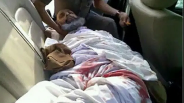 دو سال پیش در جریان بازداشت شیخ نمر به پای او شلیک شد