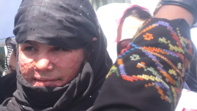 په لاریون کوونکو کې هغه مېرمن هم وه چې تېر کال د کورني تاوتریخوالي په ترڅ کې یې پر مخ تیزاب شیندل شوي وو.