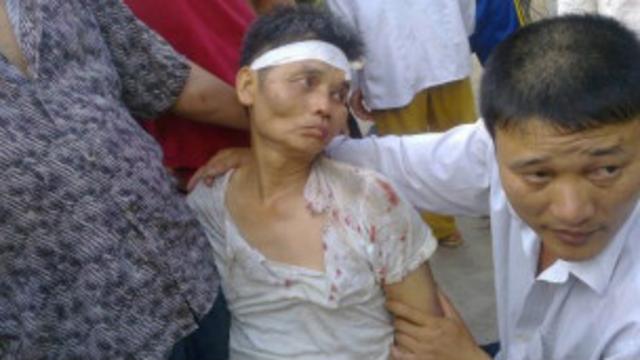 Một người dân Văn Giang bị đánh