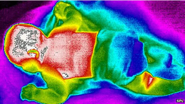 चित्र में दिखाई दे रहा है कि बच्चे की पीठ (लाल रंग) में 'ब्राउन फैट' से किस तरह उसके अंगों को रक्षा कर रही है