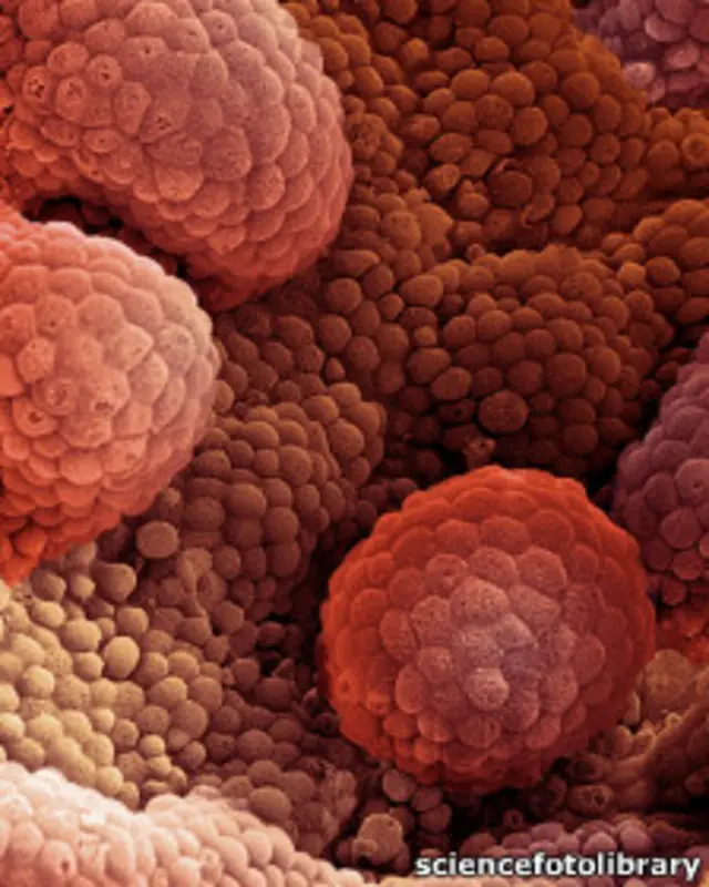 محققان ژن هایی را که شکل گیری غده پروستات را کنترل می کنند، بررسی کرده اند