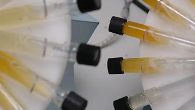 लैब में होने वाले टेस्ट के लिए भारी-भरकम उपकरणों की ज़रूरत होती है