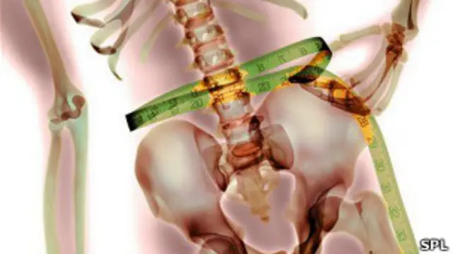 कंकाल और एनॉरेक्सिया