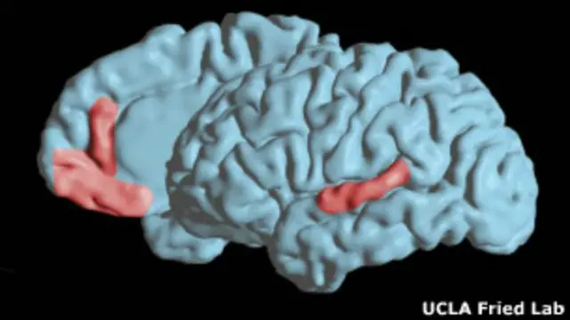 Cerebro