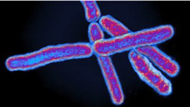 Bacteria de tuberculosis