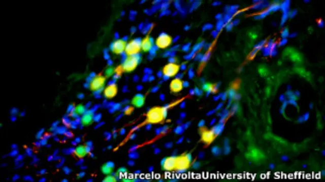 Клетки слухового нерва
