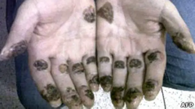 बरेरा, ड्रग तस्कर, barrera