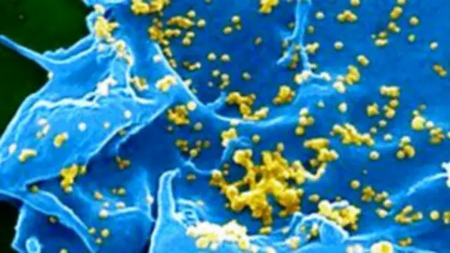 سافر المريض إلى دبي قبل اكتشاف إصابته بالفيروس