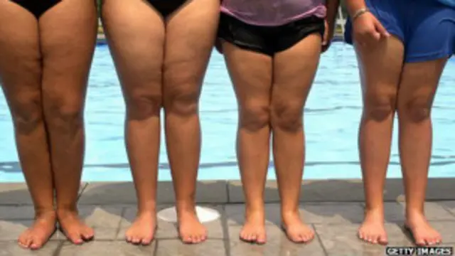 Anak-anak yang mengalami obesitas