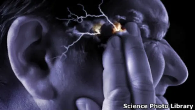 Головная боль