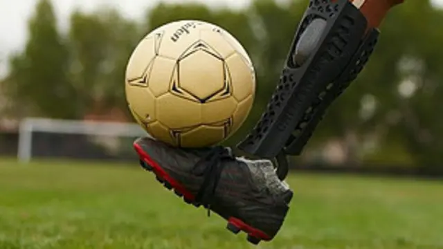 कृत्रिम अंग