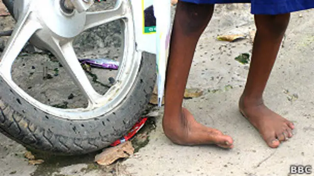 विकलांग