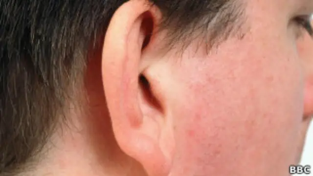 Ouvido. BBC