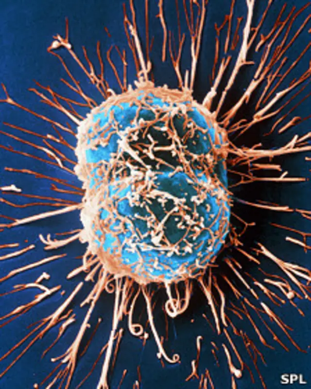 Células de cáncer cervical