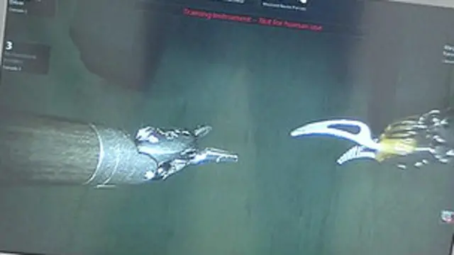 न्यू क्रॉस हॉस्पिटल के सर्जनों की टीम ने 'द विंची' रोबोट का इस्तेमाल दिल के ऑपरेशन में किया