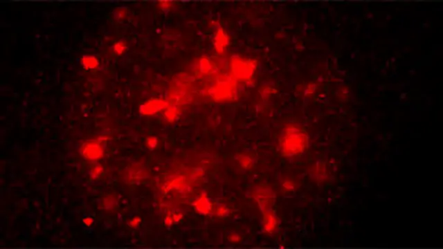 Imagen de microscopio donde se ha teñido en rojo el ADN metilado de una celula