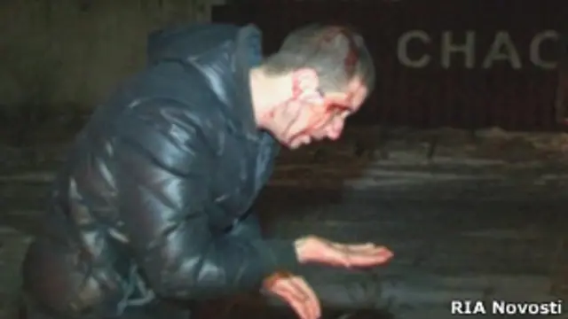 Мужчина, пострадавший при задержании у стен колонии в Копейске