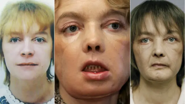 بظاہر کتا انھیں بے ہوش پا کر انہیں اٹھانا چاہتا تھا اور اس کوشش میں اس نے ان کا چہرہ چبا ڈالا