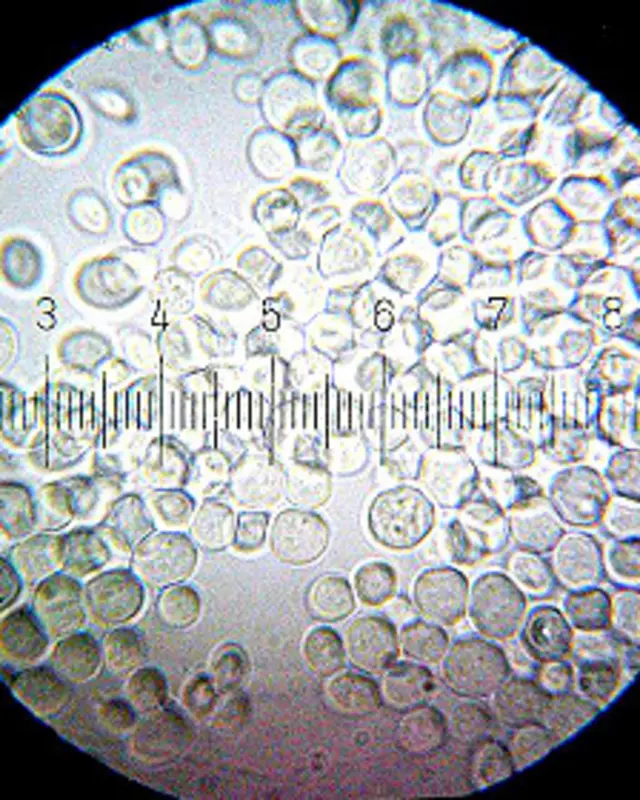 Saccharomyces cerevisiae levadura