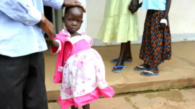 बर्किट लिमफोमा कैंसर से पीड़ित एक बच्ची.