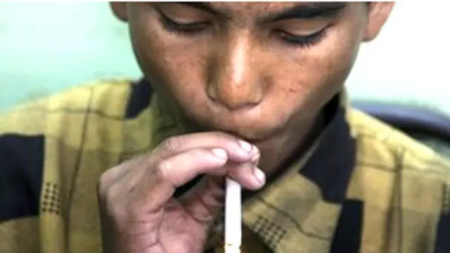 विकासशील देशों में बीमार होने की बड़ी वजह है धूम्रपान