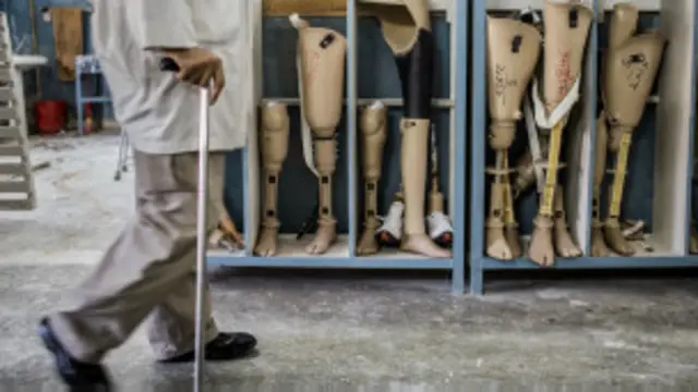 रोबोटिक अंगों को दिमाग के इशारों पर चलाना चुनौती रहा है.