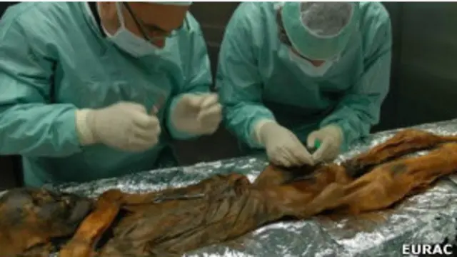 Manusia es 'Oetzi' yang berusia 5.300 tahun ditemukan membeku di pegunungan Alpen.